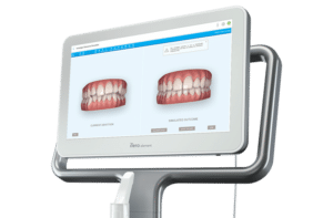 Escáner iTero Gather Orthodontics en Holly Springs, NC
